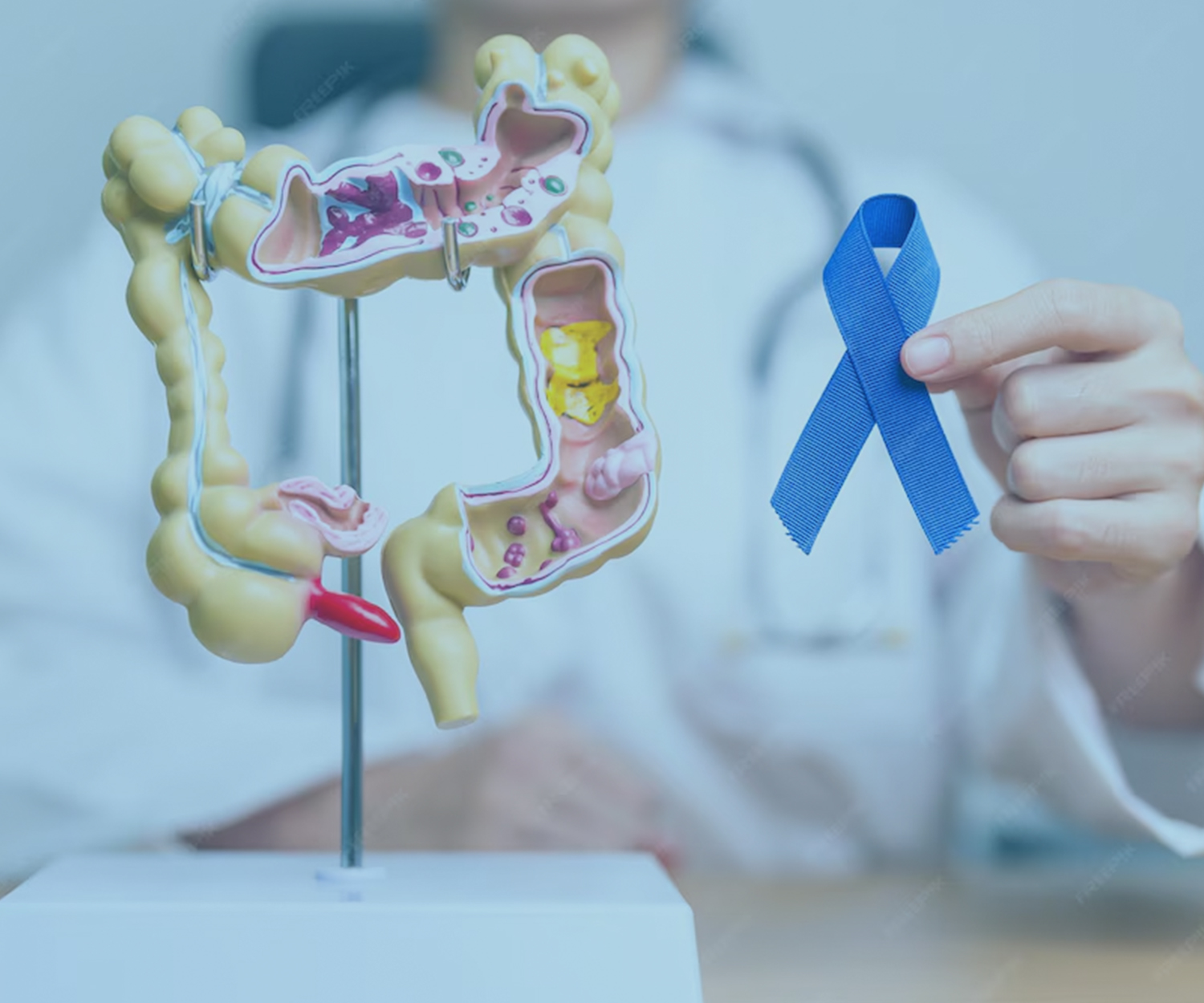 https://www.tolgahuner.com/wp-content/uploads/2024/12/Colon-cancer.jpg